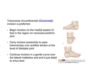 Foot Incision CTEV/ Clubfoot | PPTX