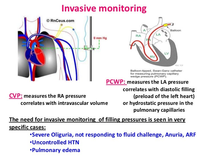 fact-file-principles-of-fluid-management