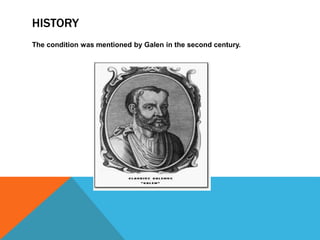 HISTORY
The condition was mentioned by Galen in the second century.
 