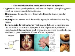 • Clasificación de las malformaciones congénitas
• Agenesia: No se produjo el desarrollo de un órgano. Ejemplos agenesia
renal, sin riñones: anoftolmía, sin ojos.
• Hipoplasia: Detención en el desarrollo. Ejemplo: labio o paladar
hendido.
• Hiperplasia: Exceso en el desarrollo, Ejemplo: Polidactilia: mas de 5
dedos.
• Persistencia de estructuras vestigiales: Falla en la involución de
una estructura transitoria. Ejemplos el ano imperforado, debido a la
persistencia de la membrana anal, el conducto arterioso persistente, que
se debe a la persistencia del 6° arco aórtico izquierdo.
 