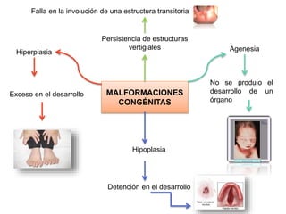 MALFORMACIONES
CONGÉNITAS
Agenesia
No se produjo el
desarrollo de un
órgano
Hipoplasia
Detención en el desarrollo
Hiperplasia
Exceso en el desarrollo
Persistencia de estructuras
vertigiales
Falla en la involución de una estructura transitoria
 