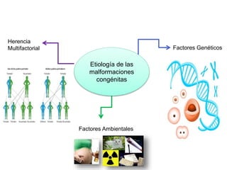 Etiología de las
malformaciones
congénitas
Factores Genéticos
Factores Ambientales
Herencia
Multifactorial
 