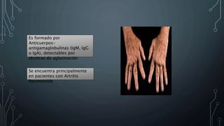 Es formado por 
Anticuerpos-antigamaglobulinas 
(IgM, IgG 
o IgA), detectables por 
técnicas de aglutinación 
Se encuentra principalmente 
en pacientes con Artritis 
Reumatoide 
 