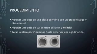 PROCEDIMIENTO 
• Agregar una gota en una placa de vidrio con un grupo testigo y 
otro control 
• Agregar una gota de suspensión de látex y mezclar 
• Rotar la placa por 2 minutos hasta observar una aglutinación 
 