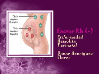 Emfermedad
Hemolita
Perinatal
Danae Henriquez
Flores
 