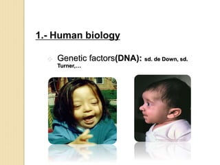 1.- Human biology
 Genetic factors(DNA): sd. de Down, sd.
Turner,…
 