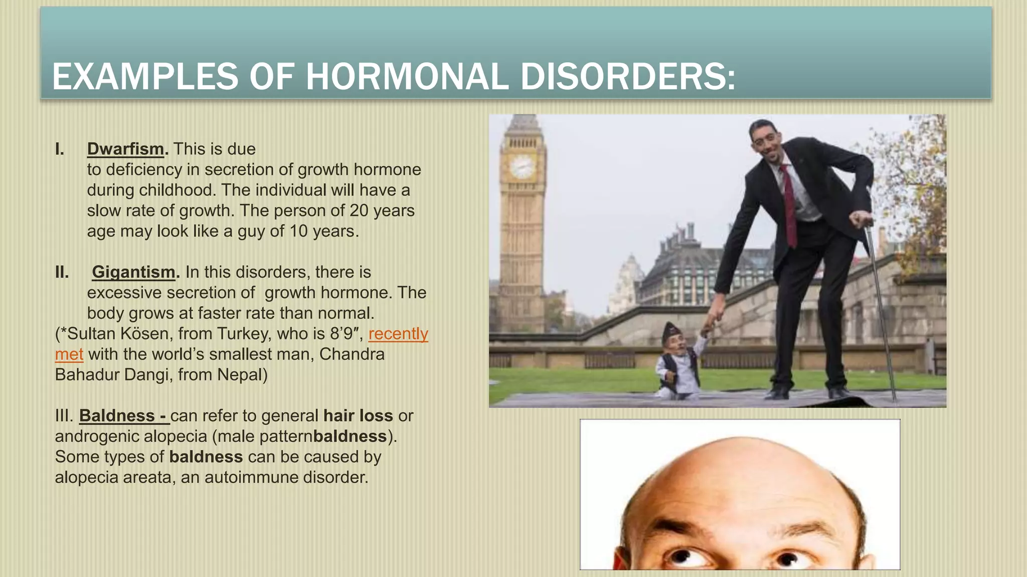 EXAMPLES OF HORMONAL DISORDERS:
I. Dwarfism. This is due
to deficiency in secretion of growth hormone
during childhood. The individual will have a
slow rate of growth. The person of 20 years
age may look like a guy of 10 years.
II. Gigantism. In this disorders, there is
excessive secretion of growth hormone. The
body grows at faster rate than normal.
(*Sultan Kösen, from Turkey, who is 8’9″, recently
met with the world’s smallest man, Chandra
Bahadur Dangi, from Nepal)
III. Baldness - can refer to general hair loss or
androgenic alopecia (male patternbaldness).
Some types of baldness can be caused by
alopecia areata, an autoimmune disorder.
 