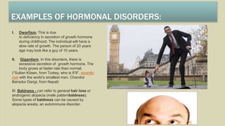 EXAMPLES OF HORMONAL DISORDERS:
I. Dwarfism. This is due
to deficiency in secretion of growth hormone
during childhood. The individual will have a
slow rate of growth. The person of 20 years
age may look like a guy of 10 years.
II. Gigantism. In this disorders, there is
excessive secretion of growth hormone. The
body grows at faster rate than normal.
(*Sultan Kösen, from Turkey, who is 8’9″, recently
met with the world’s smallest man, Chandra
Bahadur Dangi, from Nepal)
III. Baldness - can refer to general hair loss or
androgenic alopecia (male patternbaldness).
Some types of baldness can be caused by
alopecia areata, an autoimmune disorder.
 