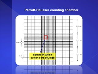 Petroff-Hausser counting chamber
 