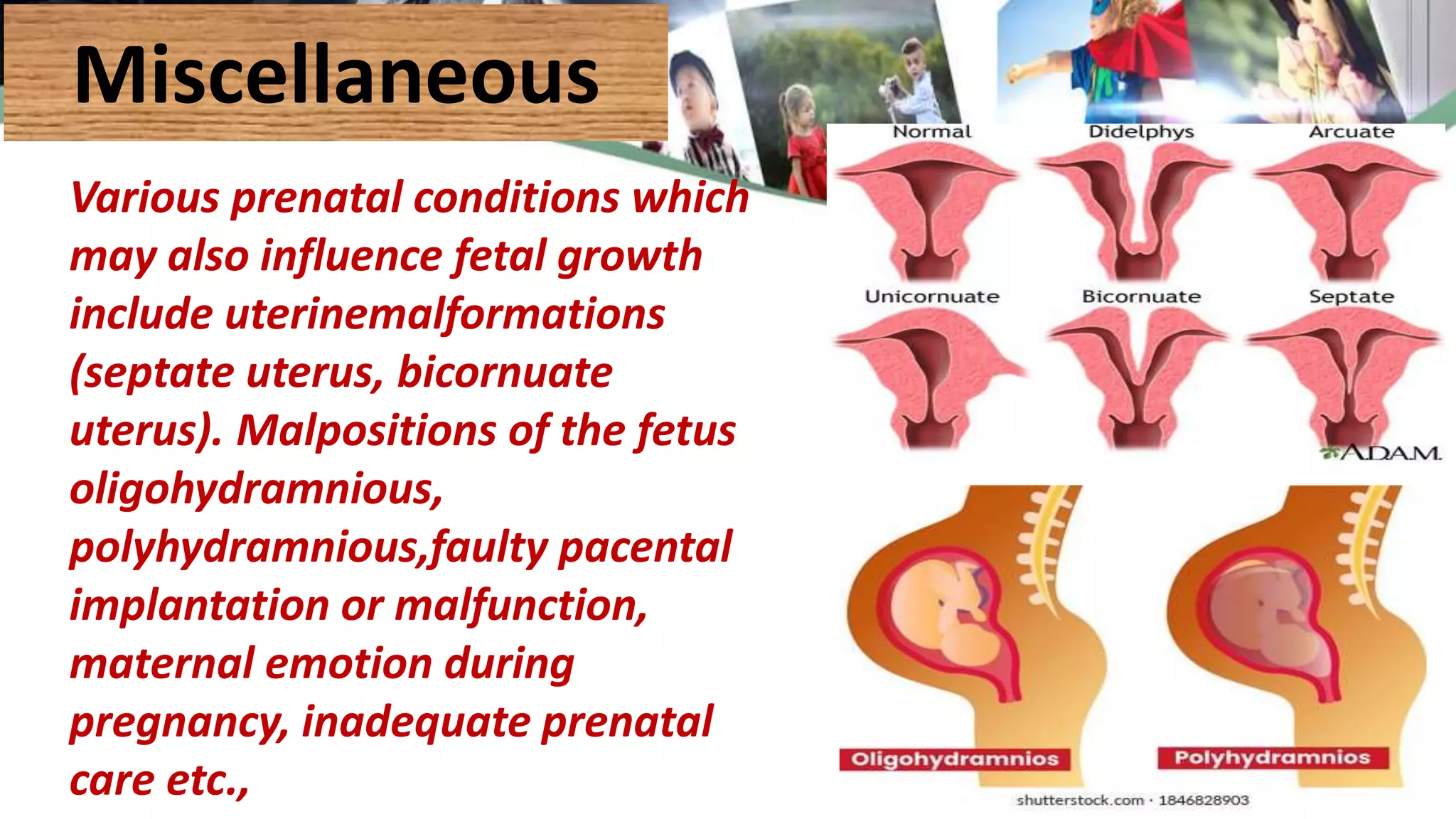 Miscellaneous
Various prenatal conditions which
may also influence fetal growth
include uterinemalformations
(septate uterus, bicornuate
uterus). Malpositions of the fetus
oligohydramnious,
polyhydramnious,faulty pacental
implantation or malfunction,
maternal emotion during
pregnancy, inadequate prenatal
care etc.,
 