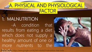 A. PHYSICAL AND PHYSIOLOGICAL
FACTOR
1. MALNUTRITION
-A condition that
results from eating a diet
which does not supply a
healthy amount of one or
more nutrients to the
Photo Credits: https://www.google.com%2Fall-india%2Fmalnutrition-free-india
 
