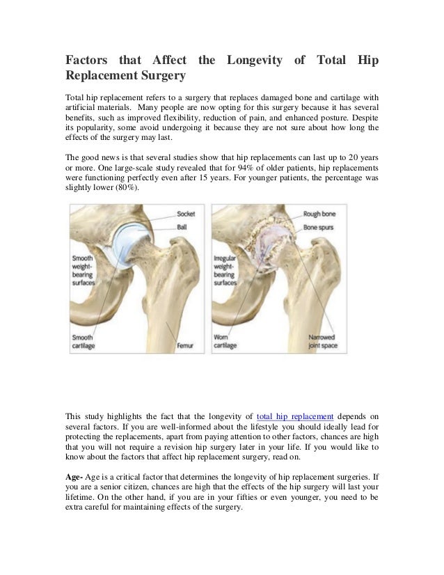 Factors that Affect the Longevity of Total Hip Replacement Surgery