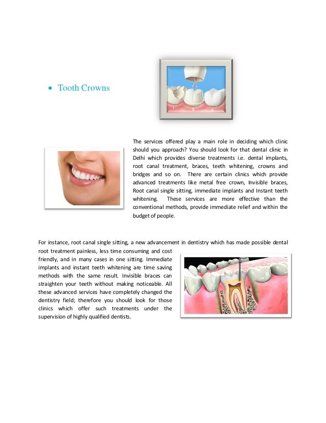 Teeth Whitening, Dental Clinic in Delhi