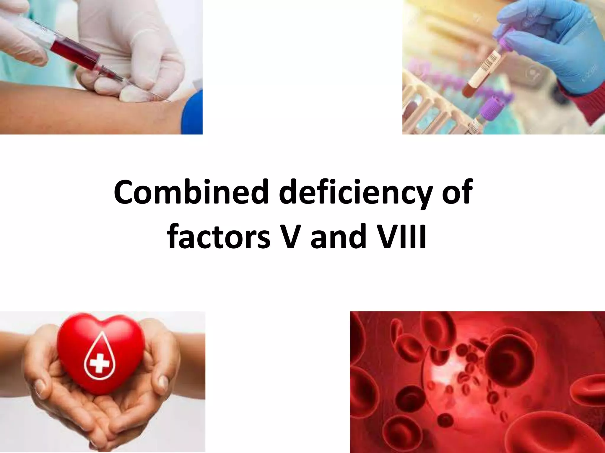 Combined deficiency of
factors V and VIII
 