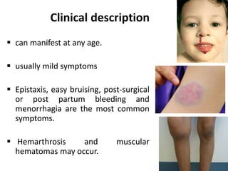 Clinical description
 can manifest at any age.
 usually mild symptoms
 Epistaxis, easy bruising, post-surgical
or post partum bleeding and
menorrhagia are the most common
symptoms.
 Hemarthrosis and muscular
hematomas may occur.
 