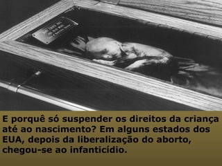 E porquê só suspender os direitos da criança até ao nascimento? Em alguns estados dos EUA, depois da liberalização do aborto, chegou-se ao infanticídio.  