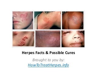 Herpes Facts & Possible Cures
Brought to you by:
HowToTreatHerpes.info

 