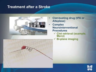 Treatment after a Stroke Clot-busting drug (tPA or Alteplase) Complex Neurointerventional Procedures Clot retrieval (example, Merci) Bi-plane imaging 
