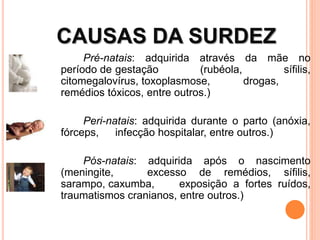 CAUSAS DA SURDEZ
Pré-natais: adquirida através da mãe no
período de gestação (rubéola, sífilis,
citomegalovírus, toxoplasmose, drogas,
remédios tóxicos, entre outros.)
Peri-natais: adquirida durante o parto (anóxia,
fórceps, infecção hospitalar, entre outros.)
Pós-natais: adquirida após o nascimento
(meningite, excesso de remédios, sífilis,
sarampo, caxumba, exposição a fortes ruídos,
traumatismos cranianos, entre outros.)
 