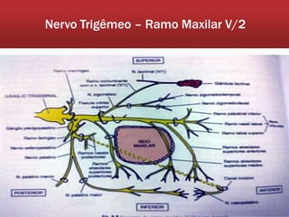 Nervo Trigêmeo – Ramo Maxilar V/2
 