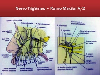 Nervo Trigêmeo – Ramo Maxilar V/2
 