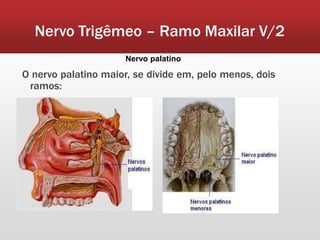 Nervo Trigêmeo – Ramo Maxilar V/2
                      Nervo palatino

O nervo palatino maior, se divide em, pelo menos, dois
 ramos:
 