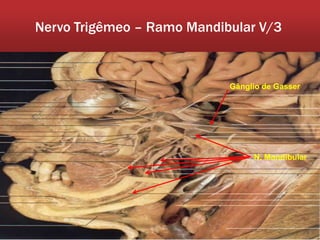 Nervo Trigêmeo – Ramo Mandibular V/3



                            Gânglio de Gasser




                                 N. Mandibular
 