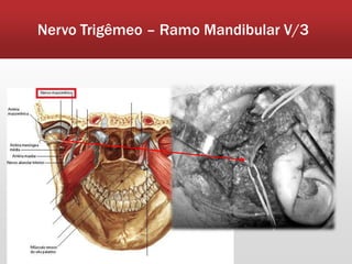 Nervo Trigêmeo – Ramo Mandibular V/3
 