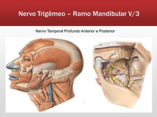 Nervo Trigêmeo – Ramo Mandibular V/3

     Nervo Temporal Profundo Anterior e Posterior
 