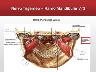 Nervo Trigêmeo – Ramo Mandibular V/3

          Ramo Pterigoideo Lateral
 