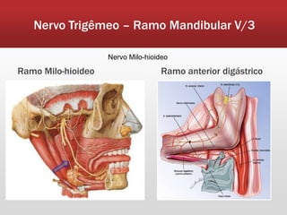 Nervo Trigêmeo – Ramo Mandibular V/3

                    Nervo Milo-hioideo

Ramo Milo-hioideo                   Ramo anterior digástrico
 