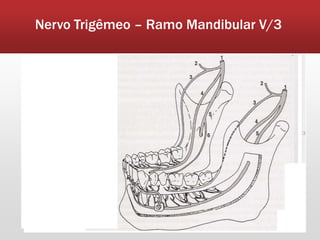 Nervo Trigêmeo – Ramo Mandibular V/3
 