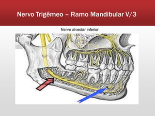 Nervo Trigêmeo – Ramo Mandibular V/3

             Nervo alveolar inferior
 