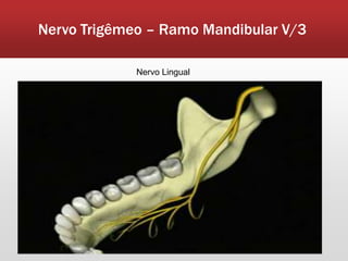 Nervo Trigêmeo – Ramo Mandibular V/3

             Nervo Lingual
 