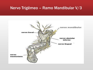 Nervo Trigêmeo – Ramo Mandibular V/3
 