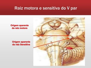 Raiz motora e sensitiva do V par
 