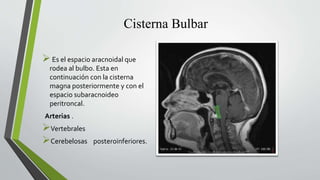 Cisterna Bulbar
Es el espacio aracnoidal que
rodea al bulbo. Esta en
continuación con la cisterna
magna posteriormente y con el
espacio subaracnoideo
peritroncal.
Arterias .
Vertebrales
Cerebelosas posteroinferiores.
 