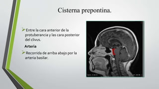Cisterna prepontina.
Entre la cara anterior de la
protuberancia y las cara posterior
del clivus.
Arteria
Recorrida de arriba abajo por la
arteria basilar.
 