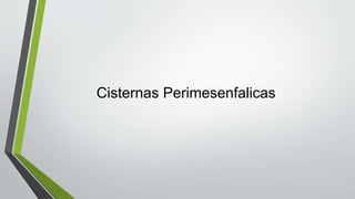 Cisternas Perimesenfalicas
 