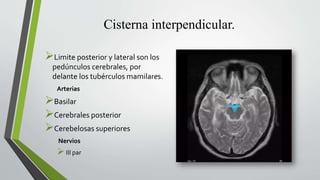 Cisterna interpendicular.
Limite posterior y lateral son los
pedúnculos cerebrales, por
delante los tubérculos mamilares.
Arterias
Basilar
Cerebrales posterior
Cerebelosas superiores
Nervios
III par
 