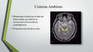 Cisterna Ambiens.
Bilaterales simétricas al lado de
línea media, por detrás se
comunican con la cisterna
cuadrigemina.
El tentorio las divide en dos.
 