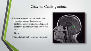 Cisterna Cuadrigemina.
Limite anterior son los tubérculos
cuadrigeminales, la comisura
posterior y el cuerpo pineal, la pared
posterior esta relacionada con el ten
torio.
Otros
Glándula pineal (superior y anterior)
 