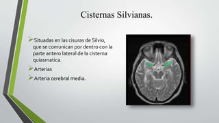 Cisternas Silvianas.
Situadas en las cisuras de Silvio,
que se comunican por dentro con la
parte antero lateral de la cisterna
quiasmatica.
Arterias
Arteria cerebral media.
 