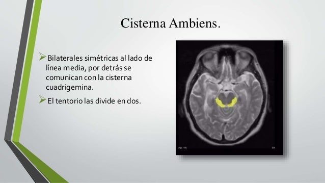 ventrículos cerebrales - FCM