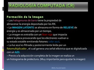 – Los halogenuros de bario tiene la propiedad de
almacenar la energía depositada por los RX.
– La                        se almacena en forma de           de
energía y es almacenada por un tiempo.
– La imagen es extraída con un láser rojo que impacta
sobre la placa provocando que los electrones vuelvan a
su estado estable emitiendo fotones color azul.
– La luz azul es filtrada y posteriormente leída por un
fotomultiplicador , el cual genera una señal eléctrica que es digitalizada
con un
– Previo a la adquisición completa de la imagen se realiza un
un histograma de prelectura. (Muy importante para ajustar la imagen)


                                         MEZA, Facundo Gastón
 