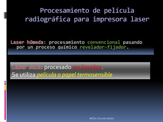 : procesamiento convencional pasando
 por un proceso químico revelador-fijador.



            : procesado sin líquidos.
Se utiliza película o papel termosensible




                               MEZA, Facundo Gastón
 