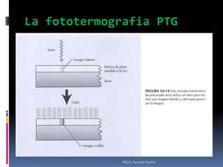 La fototermografia PTG




              MEZA, Facundo Gastón
 