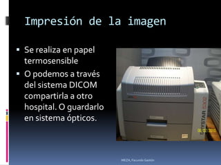 Impresión de la imagen

 Se realiza en papel
  termosensible
 O podemos a través
  del sistema DICOM
  compartirla a otro
  hospital. O guardarlo
  en sistema ópticos.



                          MEZA, Facundo Gastón
 