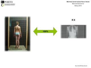 MESTRADO EM ACTIVIDADE FÍSICA E SAÚDE
               MEDICINA DESPORTIVA
                   MARÇO 2012




               RX




100%




                                              !




                    DOUTORA Mª EMÍLIA ALVES
 