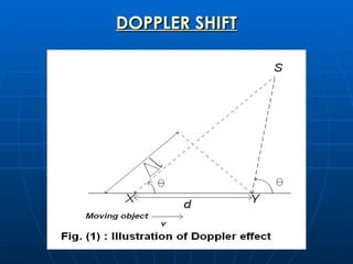 DOPPLER SHIFT 